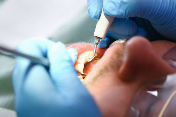 Best Emergency Broken Tooth Repair in Ashland, IL