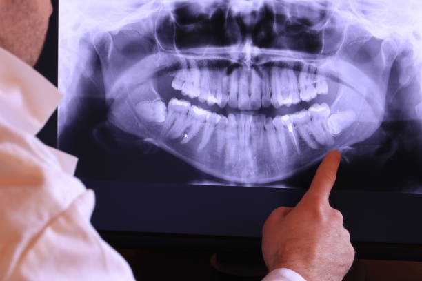 Best Walk-In Emergency Dentist in Ashland, IL